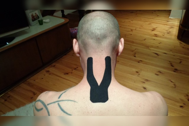 Kinesio Tape, kinesiologisch, Y-Form, Nacken